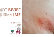 ЈУ КИЦ: Групна изложба наречена “Мојот белег”