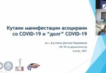 Косопад е честа појава во пост ковид периодот